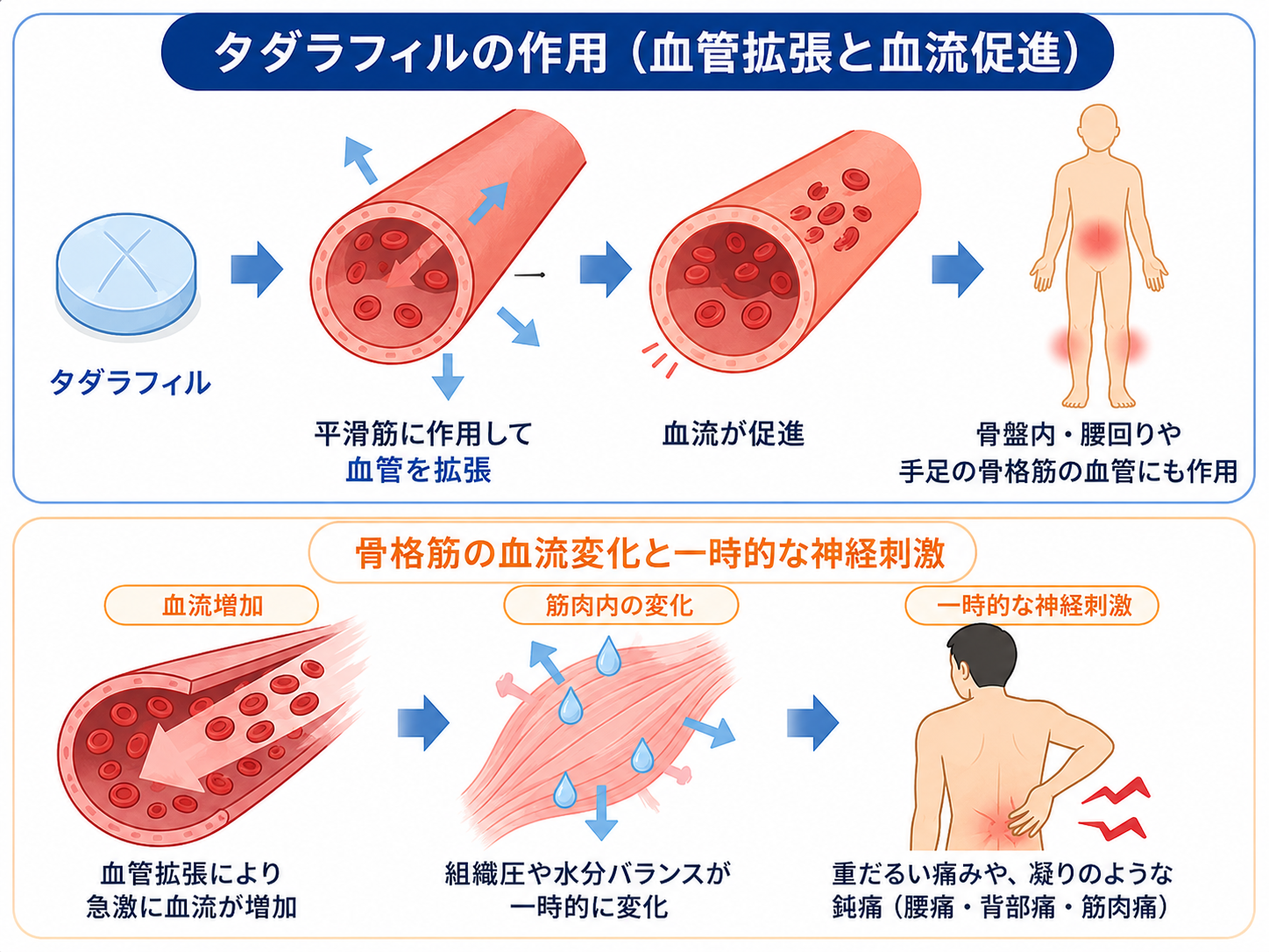 筋肉痛の記事