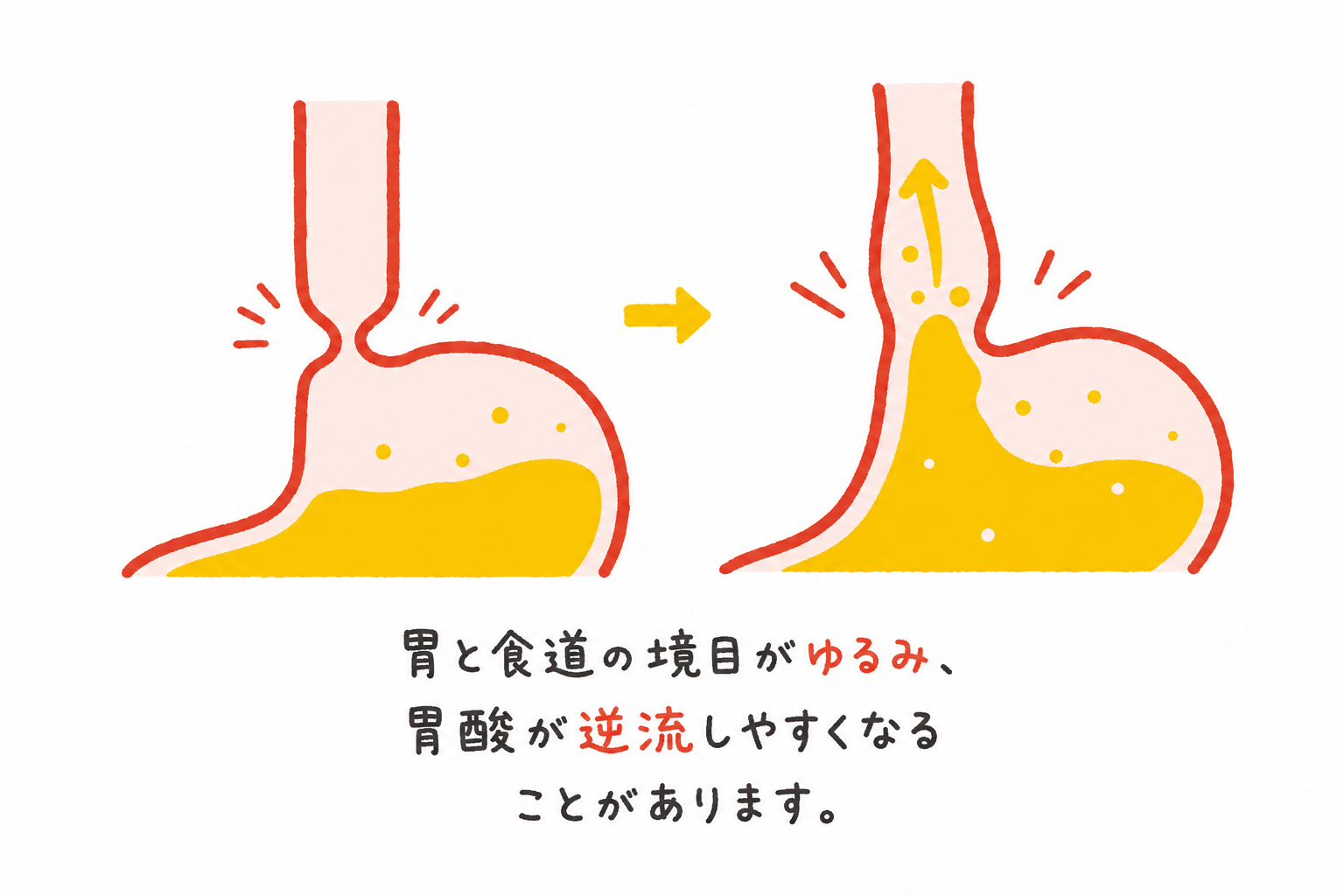 胃の不快感の記事